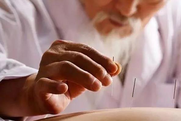 零基础自学针灸，重庆龙人学校分享四点针灸练习心得